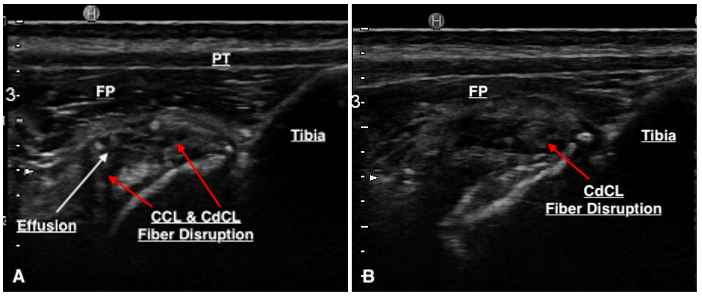 Figure 6. (A) A region of a hypoechoic structure surrounded by hyperechoic changes seen cranial to the CCL suspected to represent the CdCL. (B) Another ultrasound image identifying CdCL pathology.