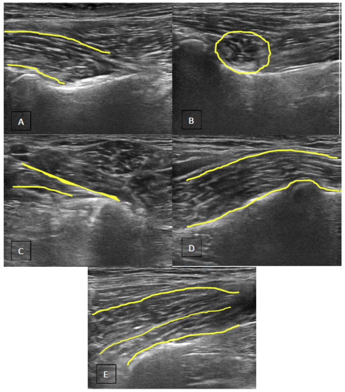 iliopsoas muscle dog