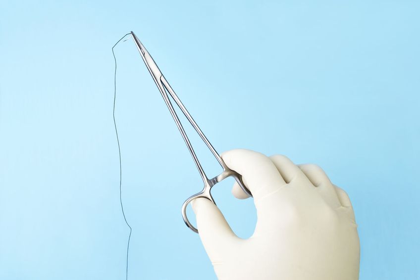 Image for Choice of Suture Pattern for Linea Alba Closure